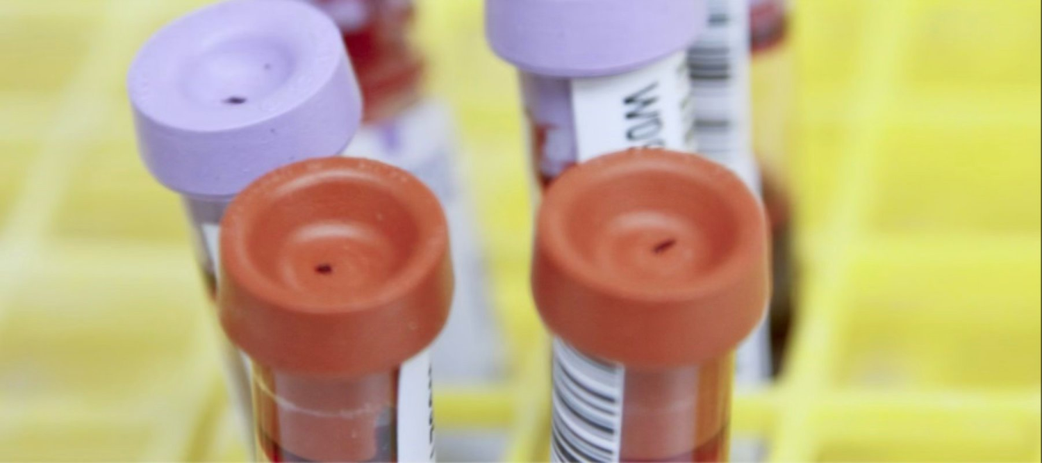 THC-Wert im Blut: Tabelle, Grenzwerte & Nachweisbarkeit